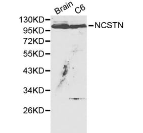Anti-NCSTN Antibody from Bioworld Technology (BS6153) - Antibodies.com