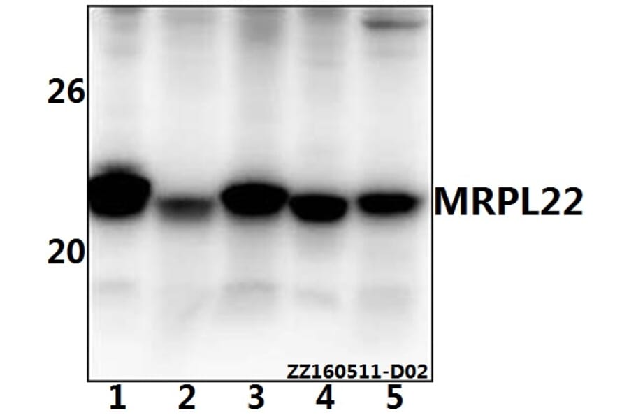 Anti-MRPL22 Antibody from Bioworld Technology (BS61535) - Antibodies.com