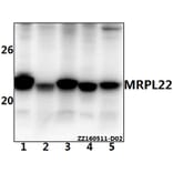 Anti-MRPL22 Antibody from Bioworld Technology (BS61535) - Antibodies.com