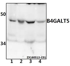 Anti-B4GALT5 Antibody from Bioworld Technology (BS61542) - Antibodies.com