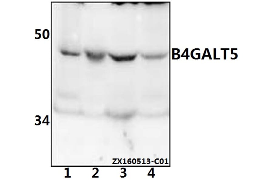 Anti-B4GALT5 Antibody from Bioworld Technology (BS61542) - Antibodies.com