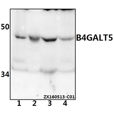Anti-B4GALT5 Antibody from Bioworld Technology (BS61542) - Antibodies.com