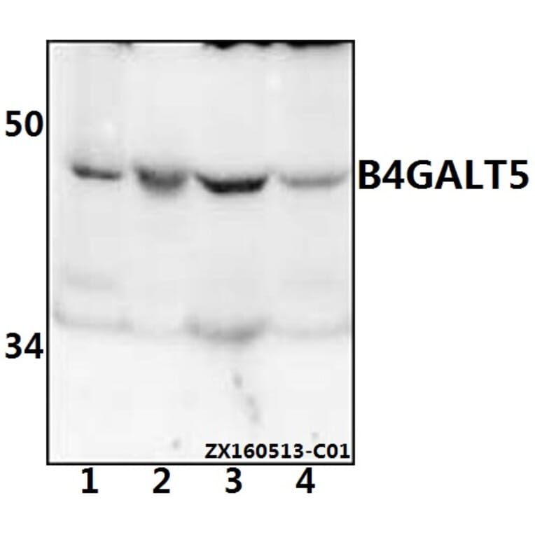 Anti-B4GALT5 Antibody from Bioworld Technology (BS61542) - Antibodies.com