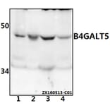 Anti-B4GALT5 Antibody from Bioworld Technology (BS61542) - Antibodies.com