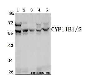 Anti-CYP11B1/2 Antibody from Bioworld Technology (BS61546) - Antibodies.com