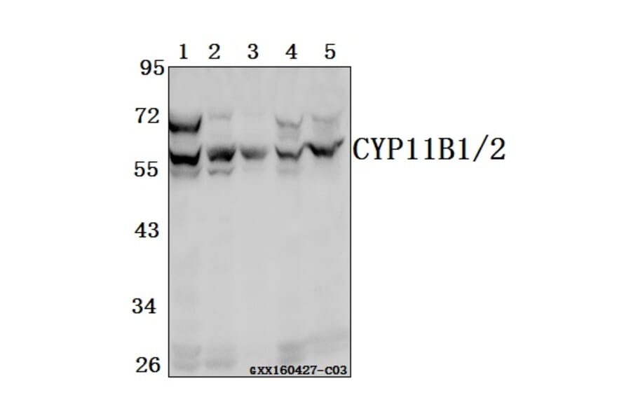 Anti-CYP11B1/2 Antibody from Bioworld Technology (BS61546) - Antibodies.com