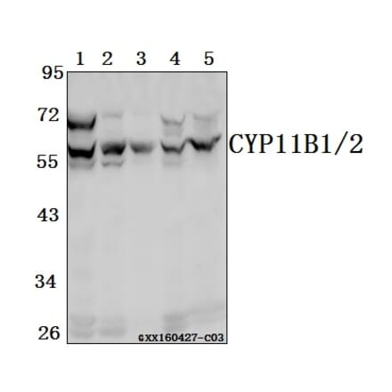 Anti-CYP11B1/2 Antibody from Bioworld Technology (BS61546) - Antibodies.com