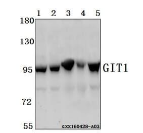 Anti-GIT1 Antibody from Bioworld Technology (BS61548) - Antibodies.com