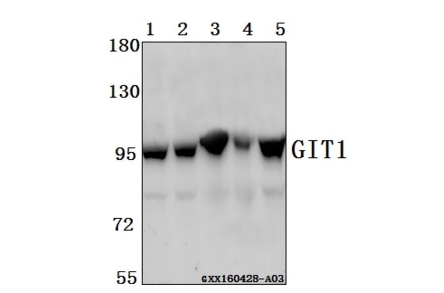 Anti-GIT1 Antibody from Bioworld Technology (BS61548) - Antibodies.com