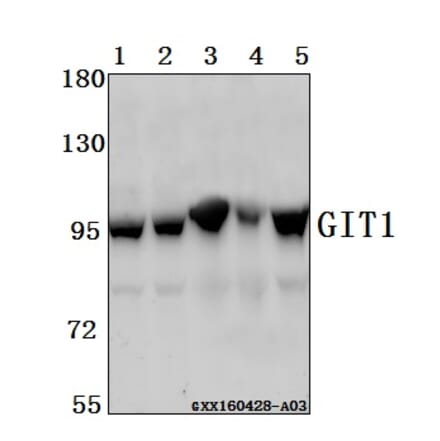 Anti-GIT1 Antibody from Bioworld Technology (BS61548) - Antibodies.com
