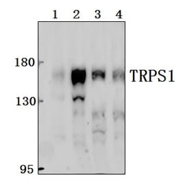 Anti-TRPS1 Antibody from Bioworld Technology (BS61549) - Antibodies.com
