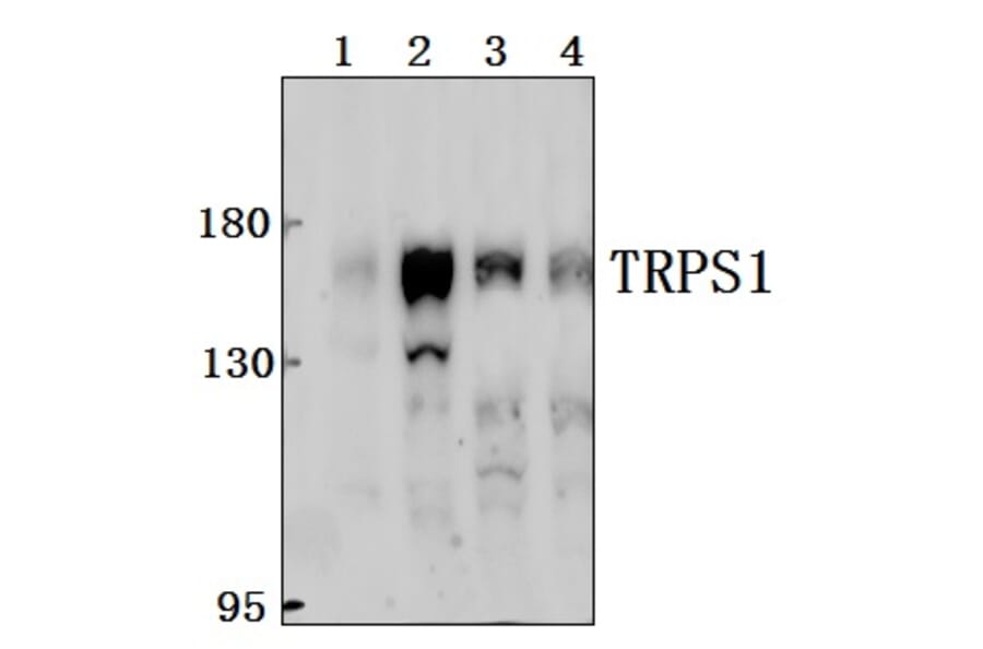 Anti-TRPS1 Antibody from Bioworld Technology (BS61549) - Antibodies.com