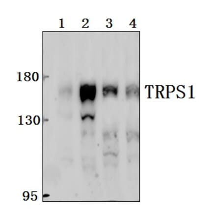Anti-TRPS1 Antibody from Bioworld Technology (BS61549) - Antibodies.com