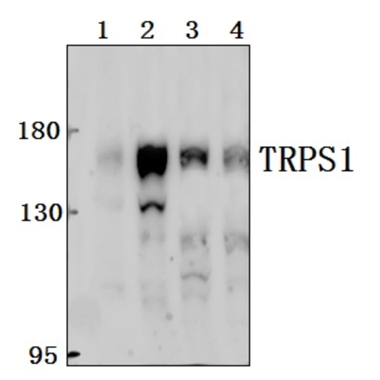 Anti-TRPS1 Antibody from Bioworld Technology (BS61549) - Antibodies.com