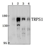 Anti-TRPS1 Antibody from Bioworld Technology (BS61549) - Antibodies.com