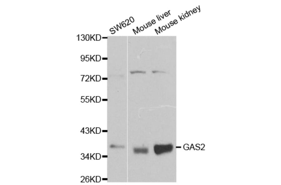 Anti-GAS2 Antibody from Bioworld Technology (BS6155) - Antibodies.com