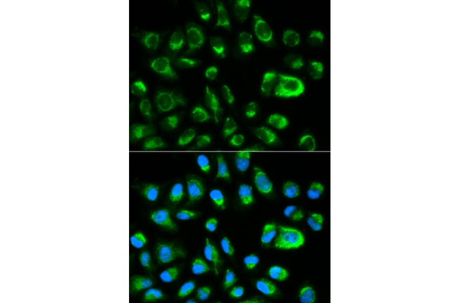 Anti-GAS2 Antibody from Bioworld Technology (BS6155) - Antibodies.com