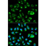 Anti-GAS2 Antibody from Bioworld Technology (BS6155) - Antibodies.com