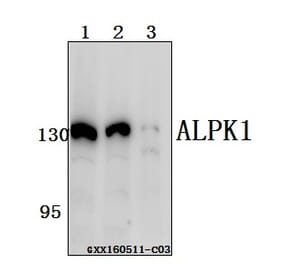 Anti-ALPK1 Antibody from Bioworld Technology (BS61558) - Antibodies.com