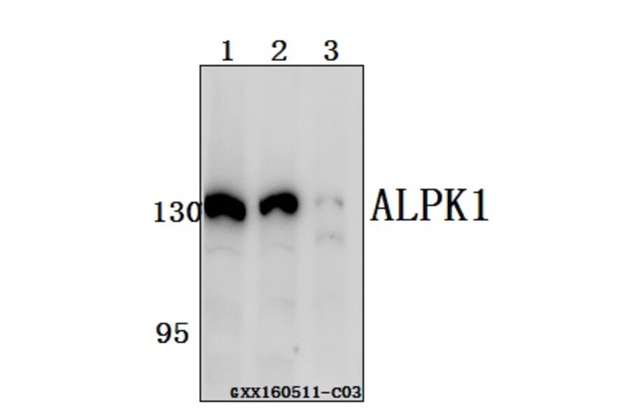 Anti-ALPK1 Antibody from Bioworld Technology (BS61558) - Antibodies.com