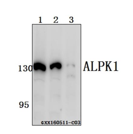 Anti-ALPK1 Antibody from Bioworld Technology (BS61558) - Antibodies.com