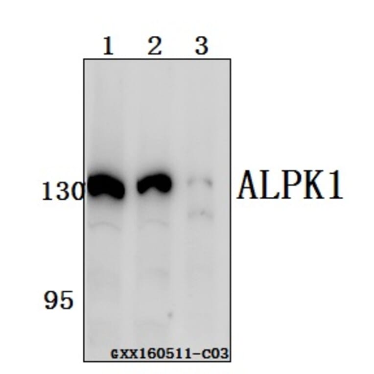 Anti-ALPK1 Antibody from Bioworld Technology (BS61558) - Antibodies.com