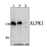 Anti-ALPK1 Antibody from Bioworld Technology (BS61558) - Antibodies.com