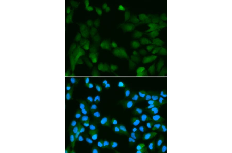 Anti-PHPT1 Antibody from Bioworld Technology (BS6156) - Antibodies.com