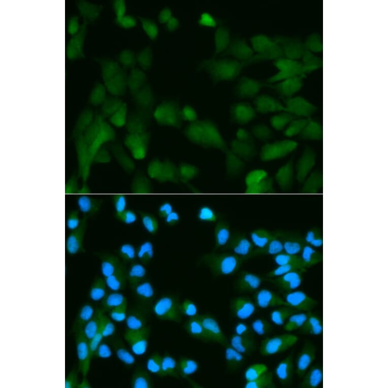 Anti-PHPT1 Antibody from Bioworld Technology (BS6156) - Antibodies.com