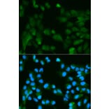 Anti-PHPT1 Antibody from Bioworld Technology (BS6156) - Antibodies.com