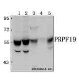 Anti-PRPF19 Antibody from Bioworld Technology (BS61565) - Antibodies.com