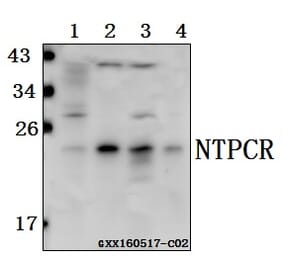 Anti-NTPCR Antibody from Bioworld Technology (BS61566) - Antibodies.com