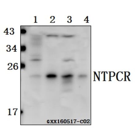 Anti-NTPCR Antibody from Bioworld Technology (BS61566) - Antibodies.com