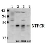 Anti-NTPCR Antibody from Bioworld Technology (BS61566) - Antibodies.com