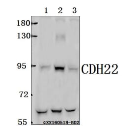 Anti-CDH22 Antibody from Bioworld Technology (BS61569) - Antibodies.com