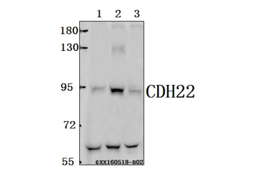 Anti-CDH22 Antibody from Bioworld Technology (BS61569) - Antibodies.com