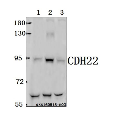 Anti-CDH22 Antibody from Bioworld Technology (BS61569) - Antibodies.com