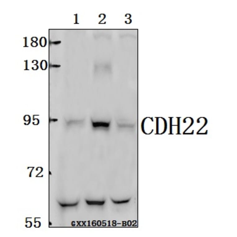 Anti-CDH22 Antibody from Bioworld Technology (BS61569) - Antibodies.com