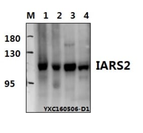 Anti-IARS2 Antibody from Bioworld Technology (BS61574) - Antibodies.com