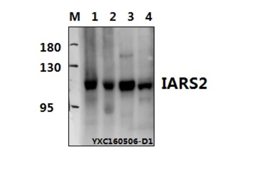 Anti-IARS2 Antibody from Bioworld Technology (BS61574) - Antibodies.com