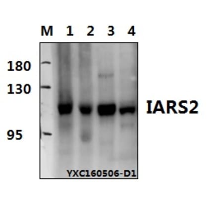 Anti-IARS2 Antibody from Bioworld Technology (BS61574) - Antibodies.com