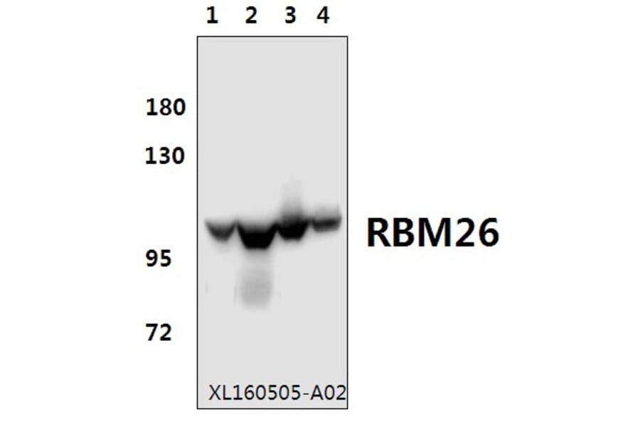 Anti-RBM26 Antibody from Bioworld Technology (BS61577) - Antibodies.com