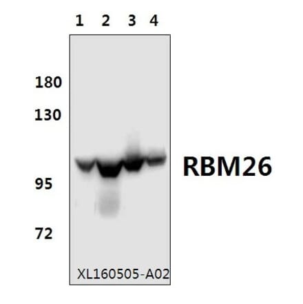 Anti-RBM26 Antibody from Bioworld Technology (BS61577) - Antibodies.com