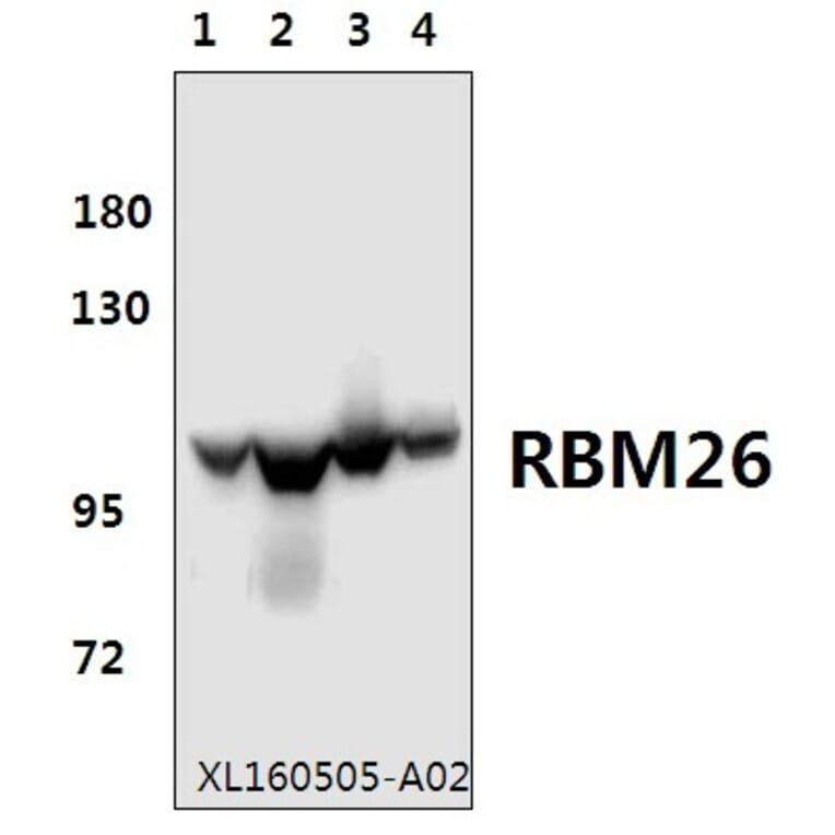Anti-RBM26 Antibody from Bioworld Technology (BS61577) - Antibodies.com