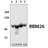 Anti-RBM26 Antibody from Bioworld Technology (BS61577) - Antibodies.com