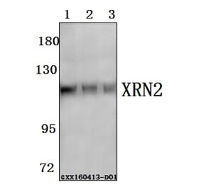 Anti-XRN2 Antibody from Bioworld Technology (BS61578) - Antibodies.com