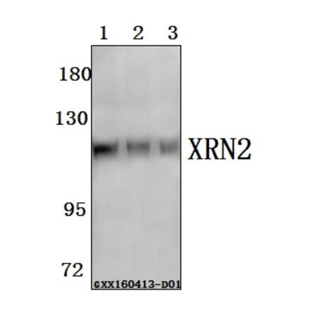 Anti-XRN2 Antibody from Bioworld Technology (BS61578) - Antibodies.com