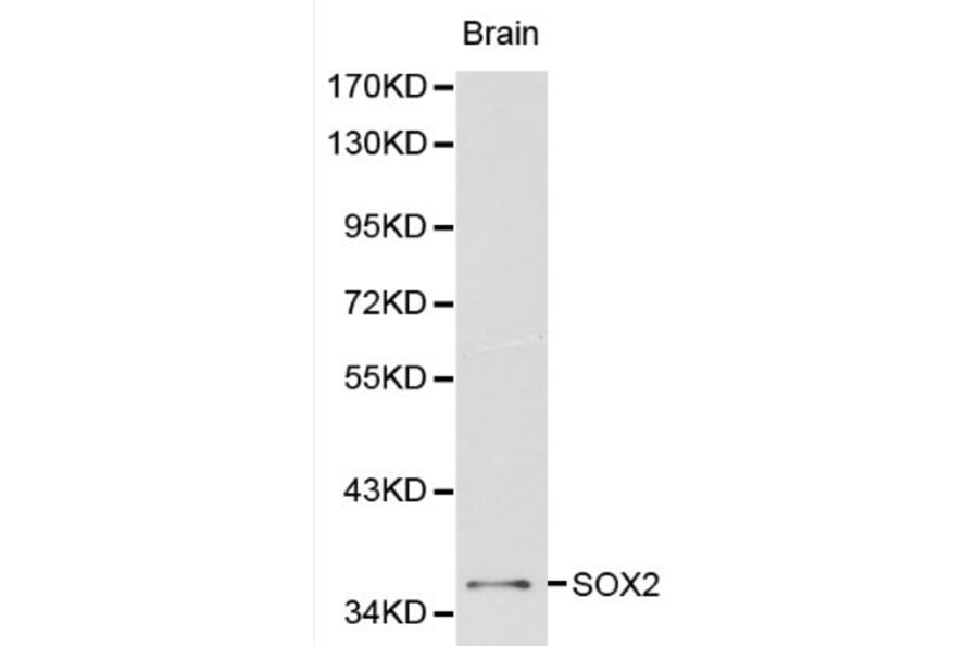 Anti-Sox2 Antibody from Bioworld Technology (BS6161) - Antibodies.com