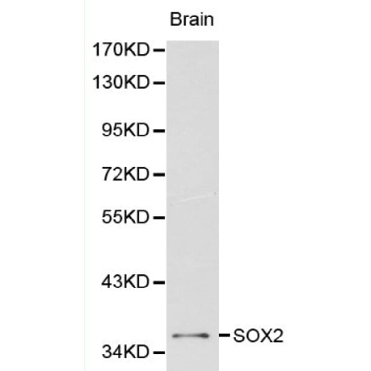 Anti-Sox2 Antibody from Bioworld Technology (BS6161) - Antibodies.com