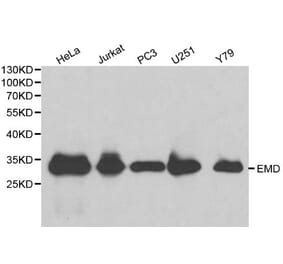 Anti-EMD Antibody from Bioworld Technology (BS6162) - Antibodies.com